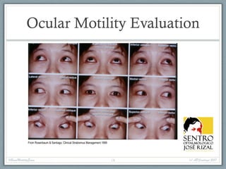 Ocular Motility Evaluation
From Rosenbaum & Santiago, Clinical Strabismus Management 1999
#BasicMotilityExam (c) APSantiago 201718
 