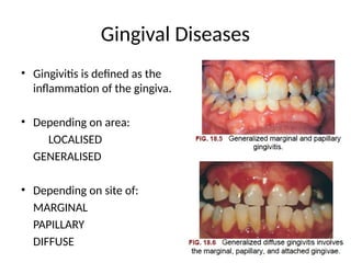 lates classification of peridontal disesases 2018 2019 | PPTX