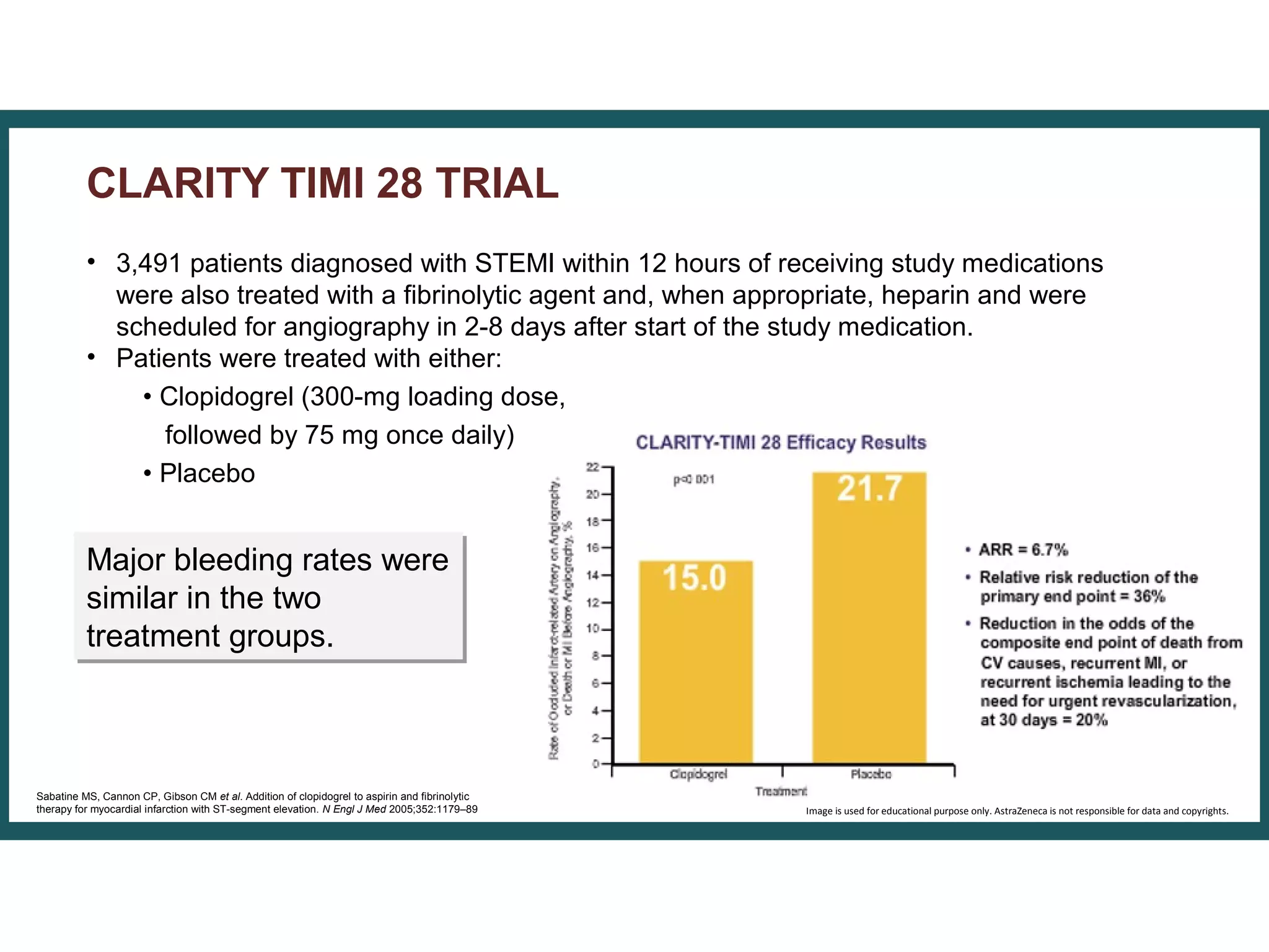 • 3,491 patients diagnosed with STEMI within 12 hours of receiving study medications
were also treated with a fibrinolytic agent and, when appropriate, heparin and were
scheduled for angiography in 2-8 days after start of the study medication.
• Patients were treated with either:
• Clopidogrel (300-mg loading dose,
followed by 75 mg once daily)
• Placebo
CLARITY TIMI 28 TRIAL
Major bleeding rates were
similar in the two
treatment groups.
Major bleeding rates were
similar in the two
treatment groups.
Sabatine MS, Cannon CP, Gibson CM et al. Addition of clopidogrel to aspirin and fibrinolytic
therapy for myocardial infarction with ST-segment elevation. N Engl J Med 2005;352:1179–89 Image is used for educational purpose only. AstraZeneca is not responsible for data and copyrights.
 