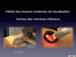 Intérêt des moyens modernes de visualisation:
Varices des membres inférieurs
Dr Jean EMSALLEM
Médecin Vasculaire
Marseille
1
 