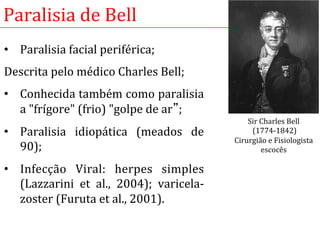 Paralisia	
  de	
  Bell	
  
•  Paralisia	
  facial	
  periférica;	
  
Descrita	
  pelo	
  médico	
  Charles	
  Bell;	
  	
  
•  Conhecida	
  também	
  como	
  paralisia	
  
a	
  "frígore"	
  (frio)	
  "golpe	
  de	
  ar”;	
  
•  Paralisia	
   idiopática	
   (meados	
   de	
  
90);	
  
•  Infecção	
   Viral:	
   herpes	
   simples	
  
(Lazzarini	
   et	
   al.,	
   2004);	
   varicela-­‐
zoster	
  (Furuta	
  et	
  al.,	
  2001).	
  
	
  
Sir	
  Charles	
  Bell	
  
	
  (1774-­‐1842)	
  
Cirurgião	
  e	
  Fisiologista	
  
escocês	
  
 