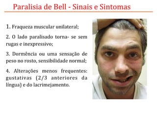 Paralisia	
  de	
  Bell	
  -­‐	
  Sinais	
  e	
  Sintomas	
  
1.	
  Fraqueza	
  muscular	
  unilateral;	
  
2.	
   O	
   lado	
   paralisado	
   torna-­‐	
   se	
   sem	
  
rugas	
  e	
  inexpressivo;	
  
3.	
   Dormência	
   ou	
   uma	
   sensação	
   de	
  
peso	
  no	
  rosto,	
  sensibilidade	
  normal;	
  
4.	
   Alterações	
   menos	
   frequentes:	
  
gustativas	
   (2/3	
   anteriores	
   da	
  
língua)	
  e	
  do	
  lacrimejamento.	
  	
  
 