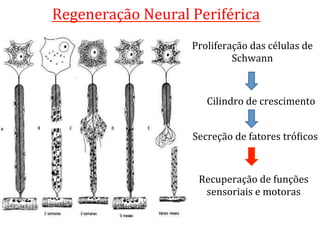 Regeneração	
  Neural	
  Periférica	
  
Proliferação	
  das	
  células	
  de	
  
Schwann	
  
Cilindro	
  de	
  crescimento	
  
Secreção	
  de	
  fatores	
  tróLicos	
  
Recuperação	
  de	
  funções	
  
sensoriais	
  e	
  motoras	
  
 