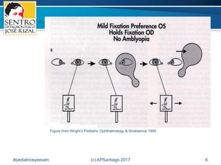 2017 Basic Pediatric Vision Examination | PDF