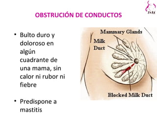OBSTRUCIÓN DE CONDUCTOS
• Bulto duro y
doloroso en
algún
cuadrante de
una mama, sin
calor ni rubor ni
fiebre
• Predispone a
mastitis
 