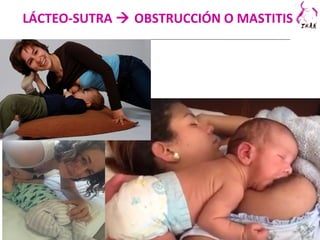 LÁCTEO-SUTRA  OBSTRUCCIÓN O MASTITIS
 