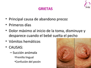 GRIETAS
• Principal causa de abandono precoz
• Primeros días
• Dolor máximo al inicio de la toma, disminuye y
desparece cuando el bebé suelta el pecho
• Vómitos hemáticos
• CAUSAS:
– Succión anómala
•Frenillo lingual
•Confusión del pezón
 