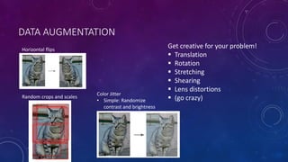 DATA AUGMENTATION
Horizontal flips
Random crops and scales
Color Jitter
• Simple: Randomize
contrast and brightness
Get creative for your problem!
 Translation
 Rotation
 Stretching
 Shearing
 Lens distortions
 (go crazy)
 