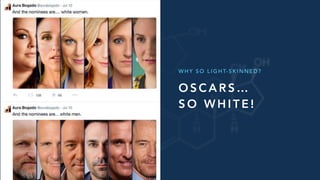 O S C A R S …
S O W H I T E !
W H Y S O L I G H T- S K I N N E D ?
 