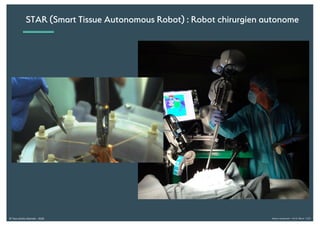 Alexia Audevart – IA & Rêve - CJD© Tous droits réservés - 2018
STAR (Smart Tissue Autonomous Robot) : Robot chirurgien autonome
 