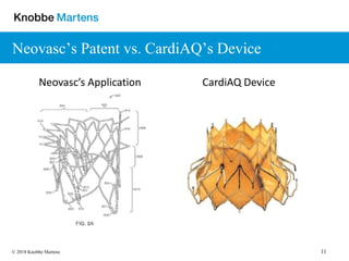 11© 2018 Knobbe Martens
Neovasc’s Patent vs. CardiAQ’s Device
Neovasc’s Application CardiAQ Device
 