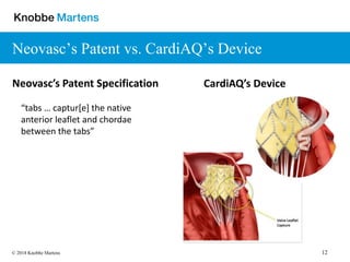 12© 2018 Knobbe Martens
Neovasc’s Patent vs. CardiAQ’s Device
“tabs … captur[e] the native
anterior leaflet and chordae
between the tabs”
Neovasc’s Patent Specification CardiAQ’s Device
 