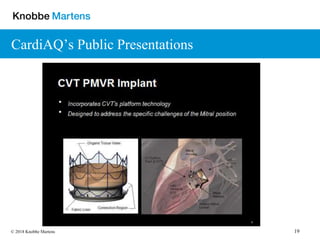 19© 2018 Knobbe Martens
CardiAQ’s Public Presentations
 