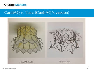 24© 2018 Knobbe Martens
CardiAQ v. Tiara (CardiAQ’s version)
 