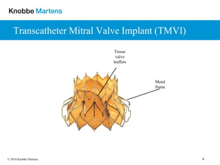 4© 2018 Knobbe Martens
Transcatheter Mitral Valve Implant (TMVI)
Metal
frame
Tissue
valve
leaflets
 