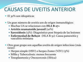 CAUSAS DE UVEITIS ANTERIOR
 El 30% son idiopáticas
 Un gran número de uveítis son de origen inmunológico:
 Muchas UA se...