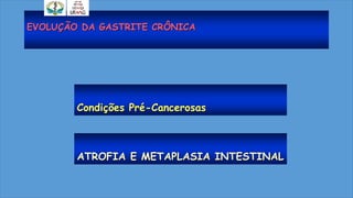 EVOLUÇÃO DA GASTRITE CRÔNICA
Condições Pré-Cancerosas
ATROFIA E METAPLASIA INTESTINAL
 