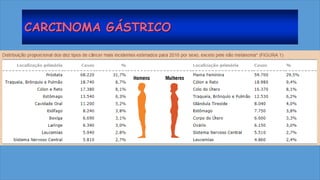 CARCINOMA GÁSTRICO
 