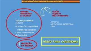 ETIOPATOGÊNESE DO CARCINOMA GÁSTRICO
RISCO PARA CARCINOMA
AGENTES
AGRESSORES
DA MUCOSA
Inflamação crônica:
H.pylori
nitritos/nitrosaminas
alimentos salgados
com conservantes,
defumados
PROTEÇÃO
DA MUCOSA
LESÕES
DOENÇAS
PRÉ-CANCEROSAS
ATROFIA
METAPLASIA INTESTINAL
UPG
 
