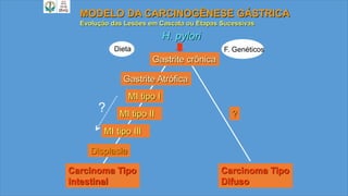 H. pylori
MODELO DA CARCINOGÊNESE GÁSTRICA
Evolução das Lesões em Cascata ou Etapas Sucessivas
Displasia
MI tipo II
MI tipo I
Gastrite Atrófica
Carcinoma Tipo
Intestinal
?
Carcinoma Tipo
Difuso
?
Gastrite crônica
MI tipo III
Dieta F. Genéticos
 