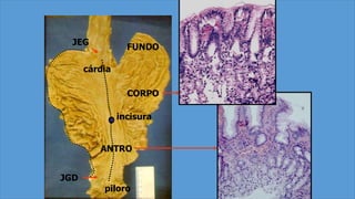 FUNDO
CORPO
ANTRO
piloro
cárdia
incisura
JEG
JGD
 