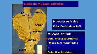 FUNDO
CORPO
ANTRO
piloro
cárdia
incisura
PC
GC
Mucosa oxíntica:
Cels. Parietais = HCl
Mucosa antral:
Cels. Mucossecretoras
(Muco bicarbonatado)
+
Cels. G = Gastrina
Tipos de Mucosa Gástrica
 