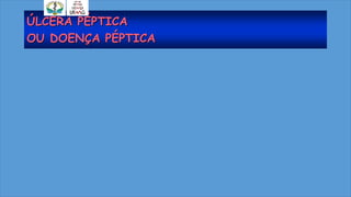 ÚLCERA PÉPTICA
OU DOENÇA PÉPTICA
 