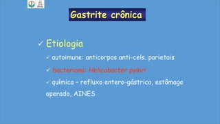 Gastrite crônica
 Etiologia
 autoimune: anticorpos anti-cels. parietais
 bacteriana: Helicobacter pylori
 química – refluxo entero-gástrico, estômago
operado, AINES
 