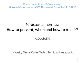 A.Odobašić
University Clinical Center Tuzla - Bosnia and Herzegovina
Mediterranean Society of Coloproctology
XI Biennial Congress of the MSCP; Thessaloniki, Greece, May 4 - 5, 2018.
Parastomal hernias:
How to prevent, when and how to repair?
1
 