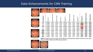 Data Enhancements for CNN Training
ACM Multimedia 2018 Tutorial The Importance of Medical Multimedia 114
 