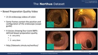 • Bowel Preparation Quality Video
• 21 GI endoscopy videos of colon
• Some frames contain the position and
configuration o...