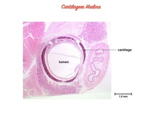 2018   tecido conjuntivo cartilaginoso