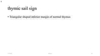 thymic sail sign
• Triangular shaped inferior margin of normal thymus
8
1/4/2018 abrakca 19
 
