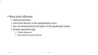 • Knee joint effusions
• lateral projections
• soft-tissue density in the suprapatellar recess
• loss of normal posterior fat plane of the quadriceps tendon
• fat pad separation sign:
• >10mm diagnostic
• <5mm means no joint effusion
1
1/4/2018 abrakca 4
 