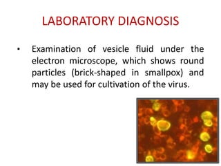 LABORATORY DIAGNOSIS
• Examination of vesicle fluid under the
electron microscope, which shows round
particles (brick-shaped in smallpox) and
may be used for cultivation of the virus.
 