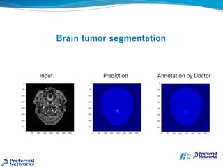 元画像
Brain tumor segmentation
Prediction Annotation by DoctorInput
 