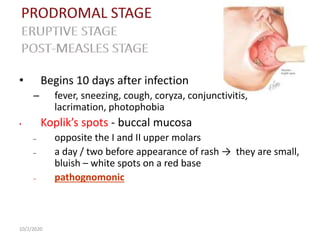 • Begins 10 days after infection
– fever, sneezing, cough, coryza, conjunctivitis,
lacrimation, photophobia
• Koplik’s spots - buccal mucosa
– opposite the I and II upper molars
– a day / two before appearance of rash → they are small,
bluish – white spots on a red base
– pathognomonic
10/2/2020
 