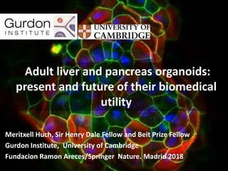Meritxell Huch, Sir Henry Dale Fellow and Beit Prize Fellow
Gurdon Institute, University of Cambridge
Fundacion Ramon Areces/Springer Nature. Madrid 2018
Adult liver and pancreas organoids:
present and future of their biomedical
utility
 