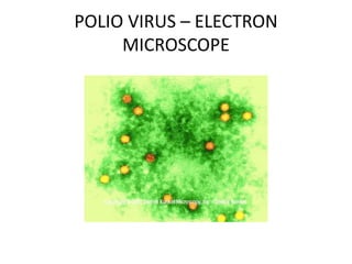 POLIO VIRUS – ELECTRON
MICROSCOPE
 
