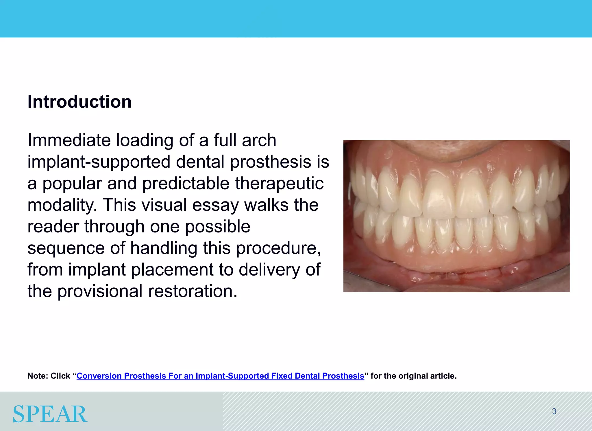 Conversion Prosthesis For an Implant-Supported Fixed Dental Prosthesis ...