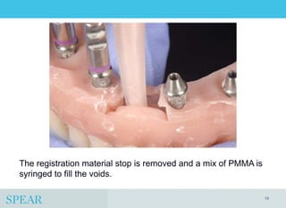 Conversion Prosthesis For an Implant-Supported Fixed Dental Prosthesis ...