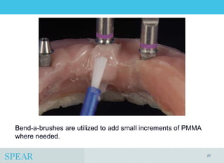 Conversion Prosthesis For an Implant-Supported Fixed Dental Prosthesis ...