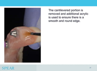 Conversion Prosthesis For an Implant-Supported Fixed Dental Prosthesis ...