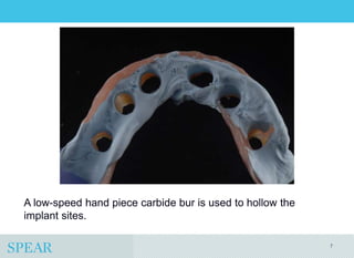 Conversion Prosthesis For an Implant-Supported Fixed Dental Prosthesis ...
