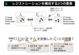 3
I1 I2pI0
2
I1 I2p I0
2p
L2
SSD, NCC
(MI)
min { }
1st Image
Template
Fixed image
model
2nd Image
Observation
Moving image
measurements
 