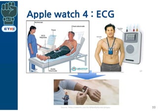 Apple watch 4 : ECG
33Source: https://steemit.com/kr/@familydoctor/qmpau
 