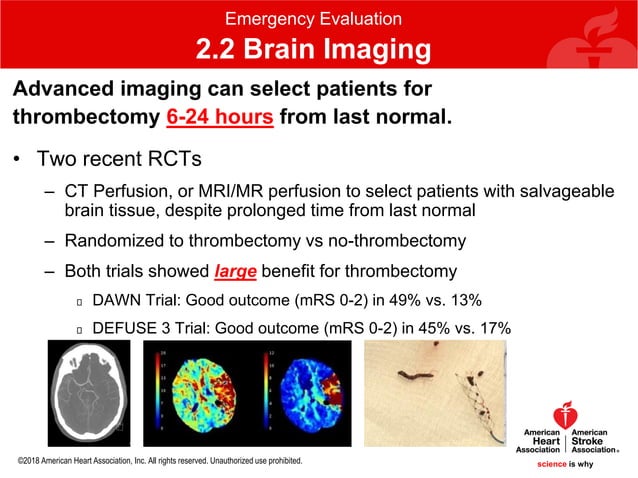 2018 AHA ASA guideline - guidelines for the early management of ...