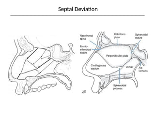Sept Nazal 2018_Anatomy___Physiology_Nose___Paranasal_Sinuses_-_Handout.pptx