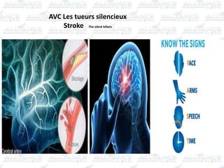AVC Les tueurs silencieux
Stroke The silent killers
 