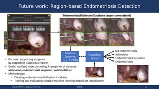 Future work: Region-based Endometriosis Detection
Klaus Schöffmann, Klagenfurt University EEC2018 11
Endometriosis/Adhesio...